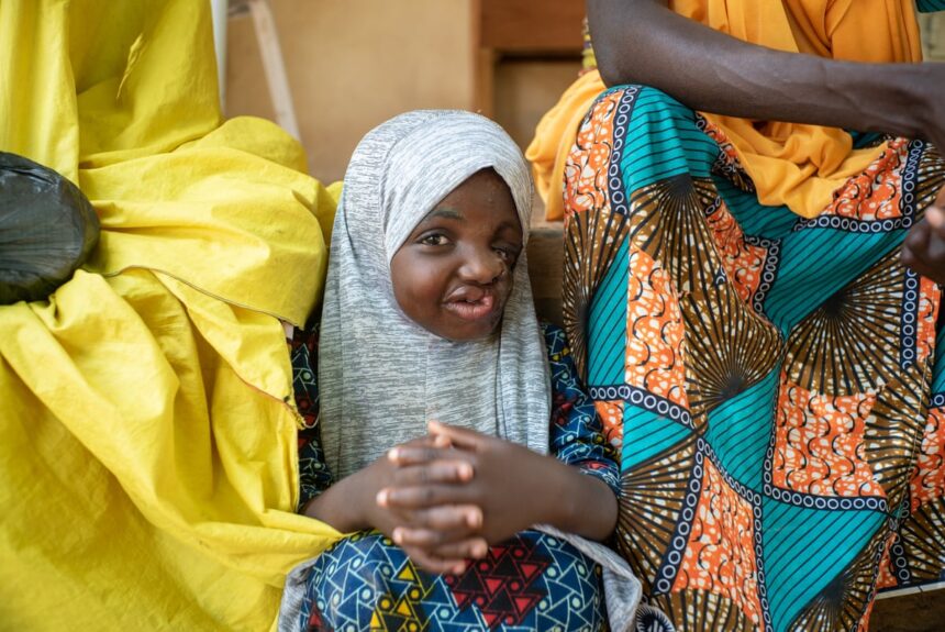 astonishing discovery could help save children from deadly disfiguring condition 69f0333ddb4a8